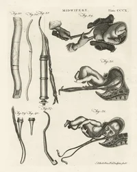 Midwifery (illustration from 